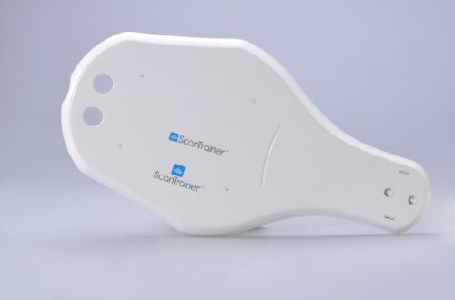 glucose monitor arm sensor