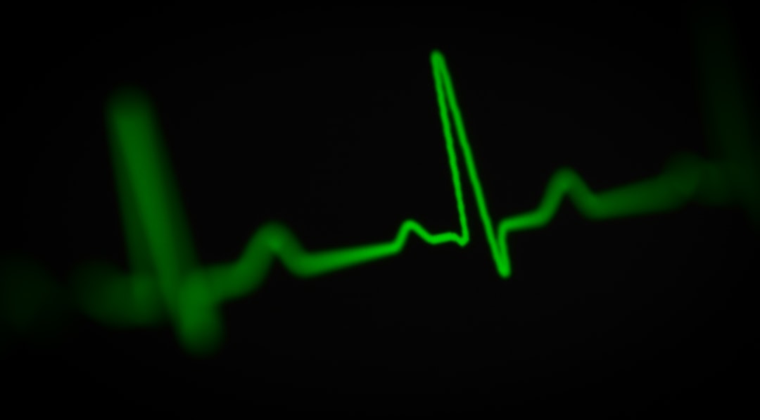 Heart rate waveform data displayed on a dark screen