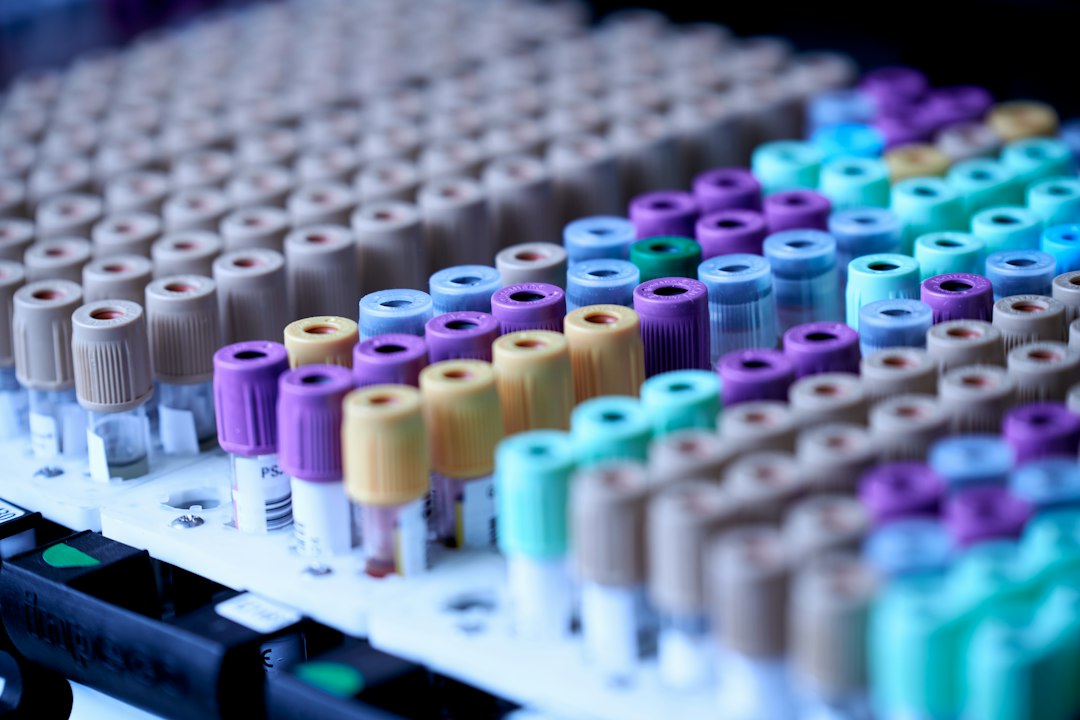 Blood test vials ready for laboratory analysis